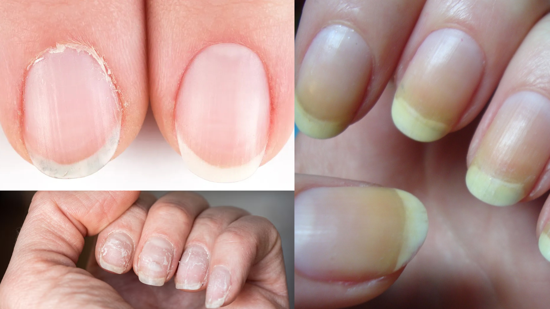 wedding nail art_unhealthy nails